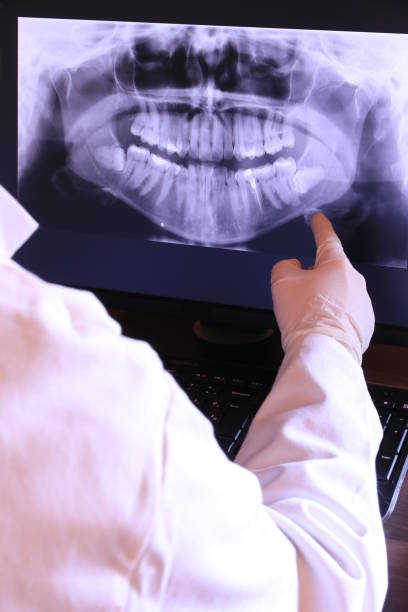 Best Emergency Dental Care for Broken or Chipped Teeth in Santa Teresa, NM